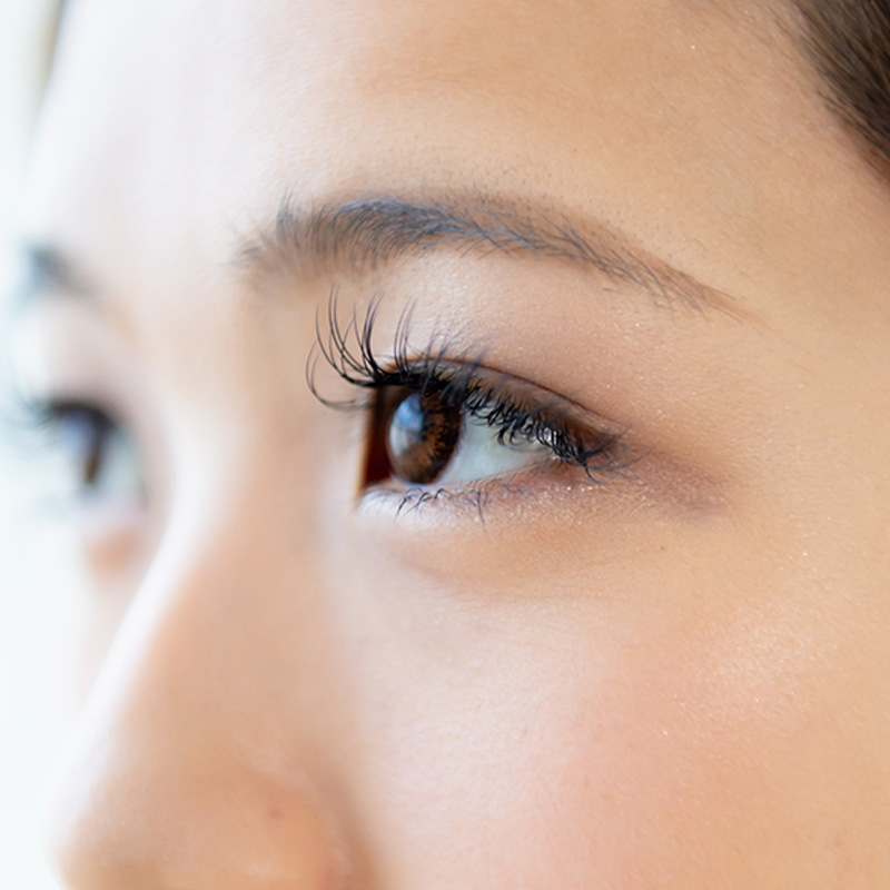 CO2フラクショナルレーザー（マドンナリフト）